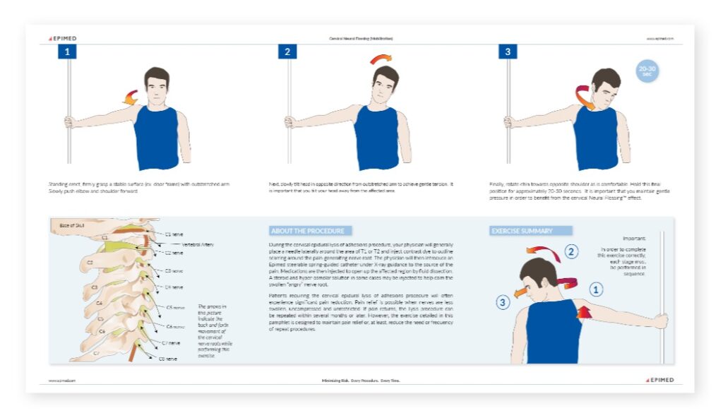 Neural Flossing Exercises